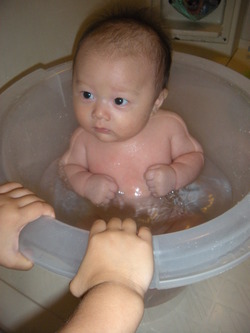 とびひの季節
