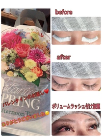 ☆脱毛キャンペーン中☆ 2018/03/18 00:02:40