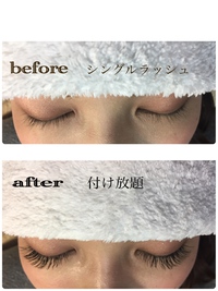 全身脱毛キャンペーン✨ 2017/02/16 14:42:21