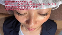 ☆脱毛&まつエクキャンペーンのご案内☆ 2018/04/15 15:55:15