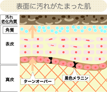 表面に汚れがたまった肌