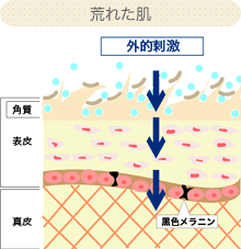 荒れた肌