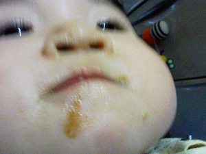 はなみずだらりんこ