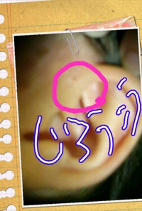 手術 2012/05/30 19:27:48