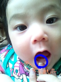 歯！！！歯！！！ 2011/10/18 14:17:54