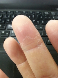 ドラキュラも逃げるわけだ・・・ 2013/08/26 13:27:42
