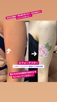 傷跡のビフォーアフターです！お客様大喜び 2019/12/09 13:53:13
