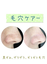 毛穴‼ 2015/11/14 21:13:55