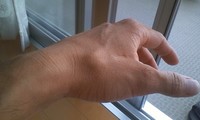骨が・・（－－；） 2009/06/29 17:10:38